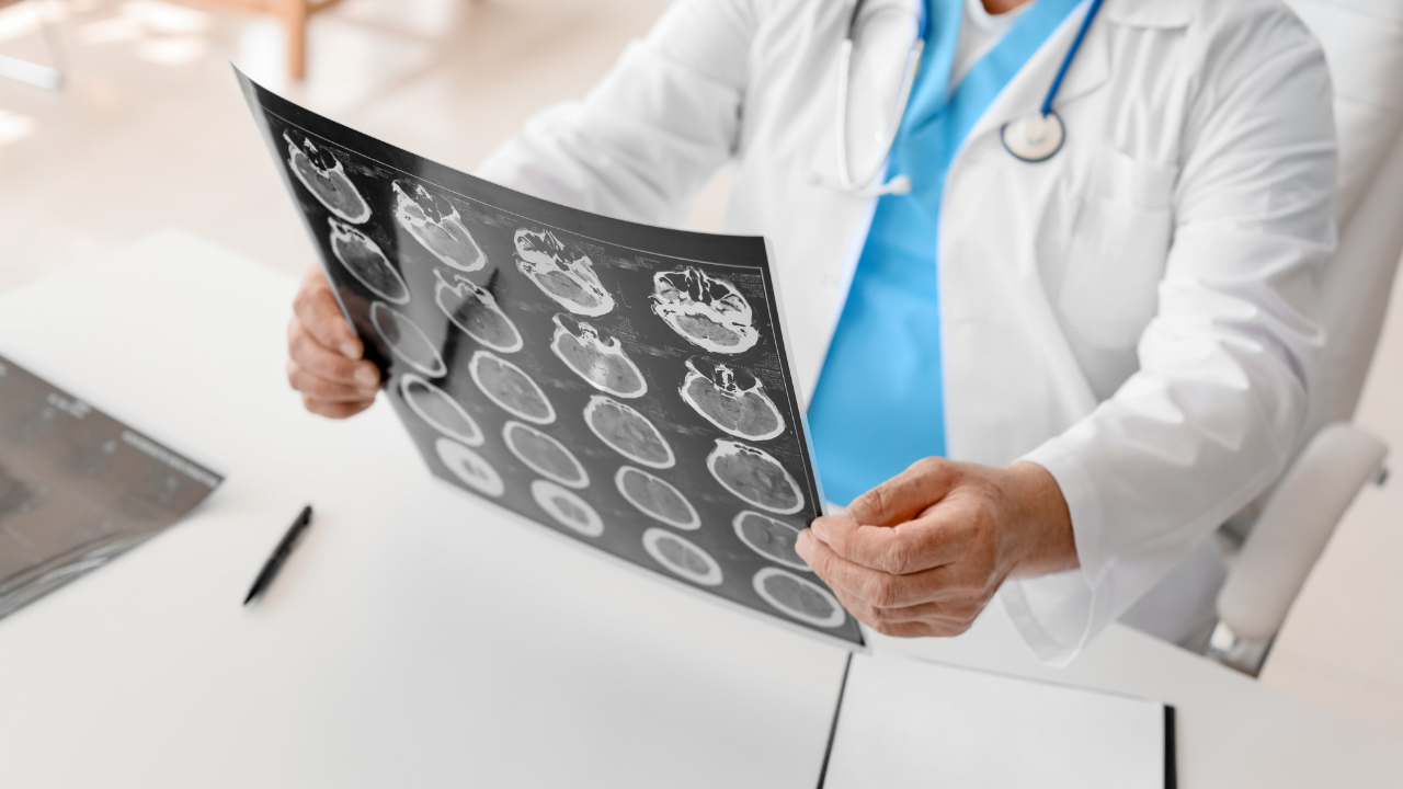 Brain Injury Settlements in Texas: What You Might Expect in the Lone Star State Brain Injury Settlements in Texas: What You Might Expect in the Lone Star State